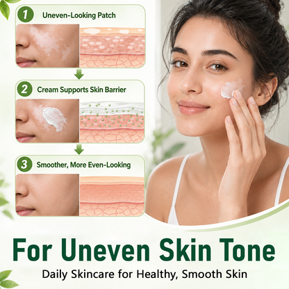 QIAWI® Herbal Vitiligo Cream