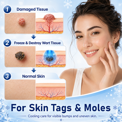 QIAWI® CryoClear Pro Bump Renewal Spray