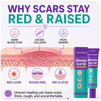 Genuinegyre® Allantoin Scar Gel- limited-time discount