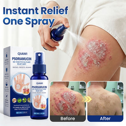 QIAWI® PsoriaMucin No-Rub Itch & Flake Relief Mist
