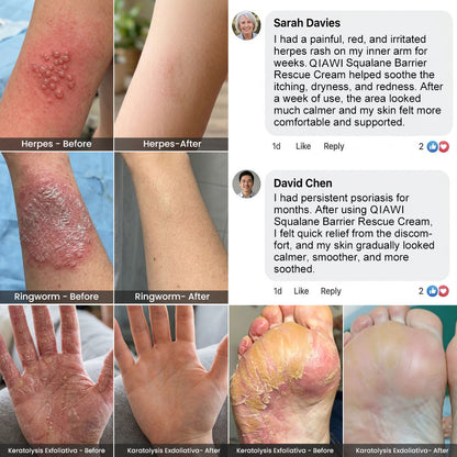 QIAWI® Squalane Barrier Rescue Cream