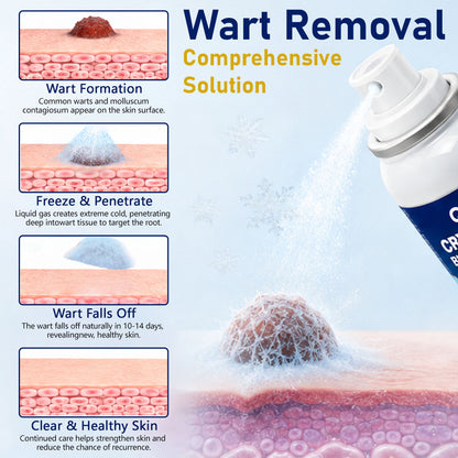 QIAWI® CryoClear Pro Bump Renewal Spray