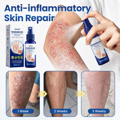 QIAWI® PsoriaMucin No-Rub Itch & Flake Relief Mist